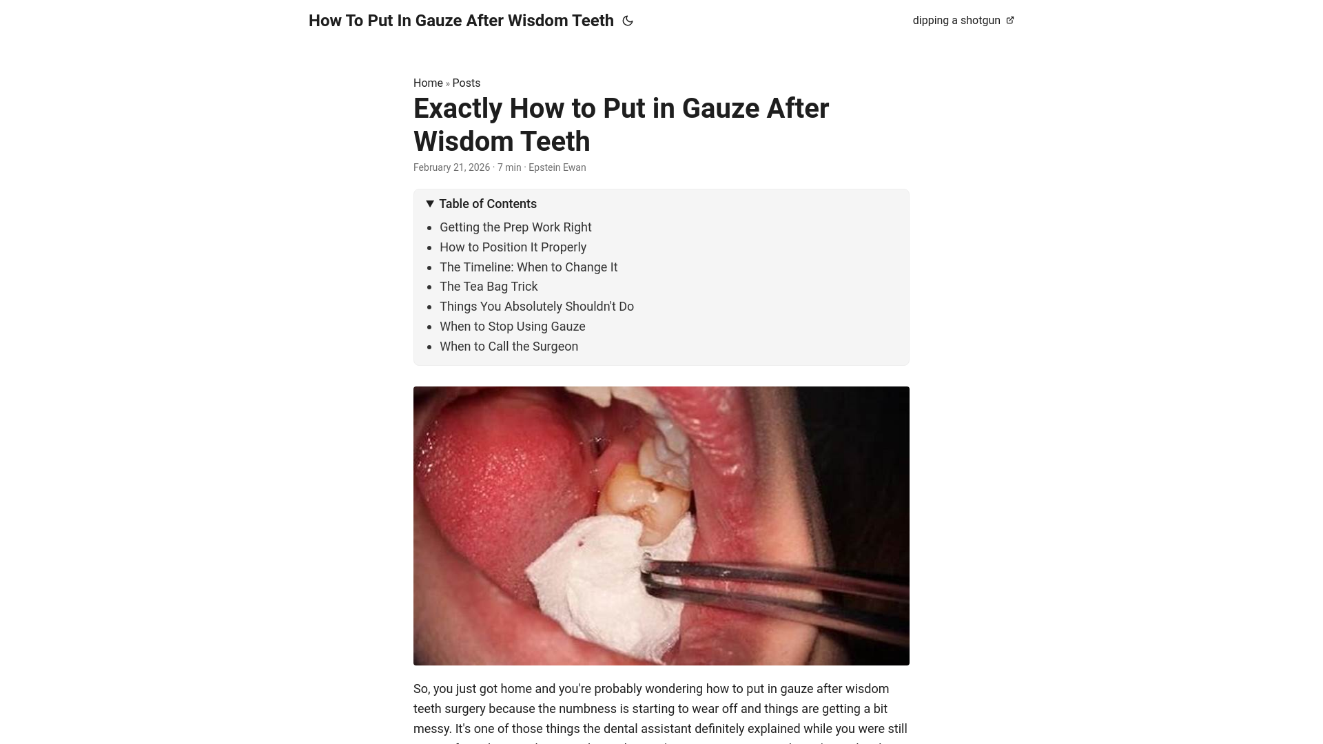 website screenshot of https://how-to-put-in-gauze-after-wisdom-teeth.pages.dev/