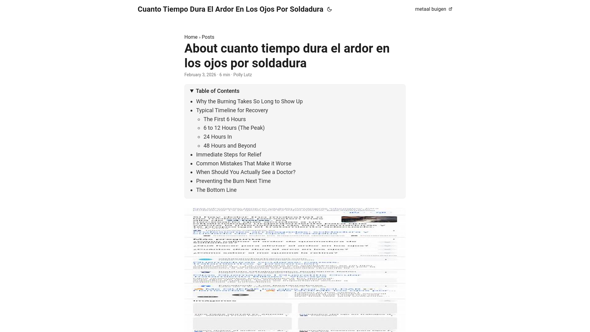 website screenshot of https://cuanto-tiempo-dura-el-ardor-en-los-ojos-por-soldadura.pages.dev/