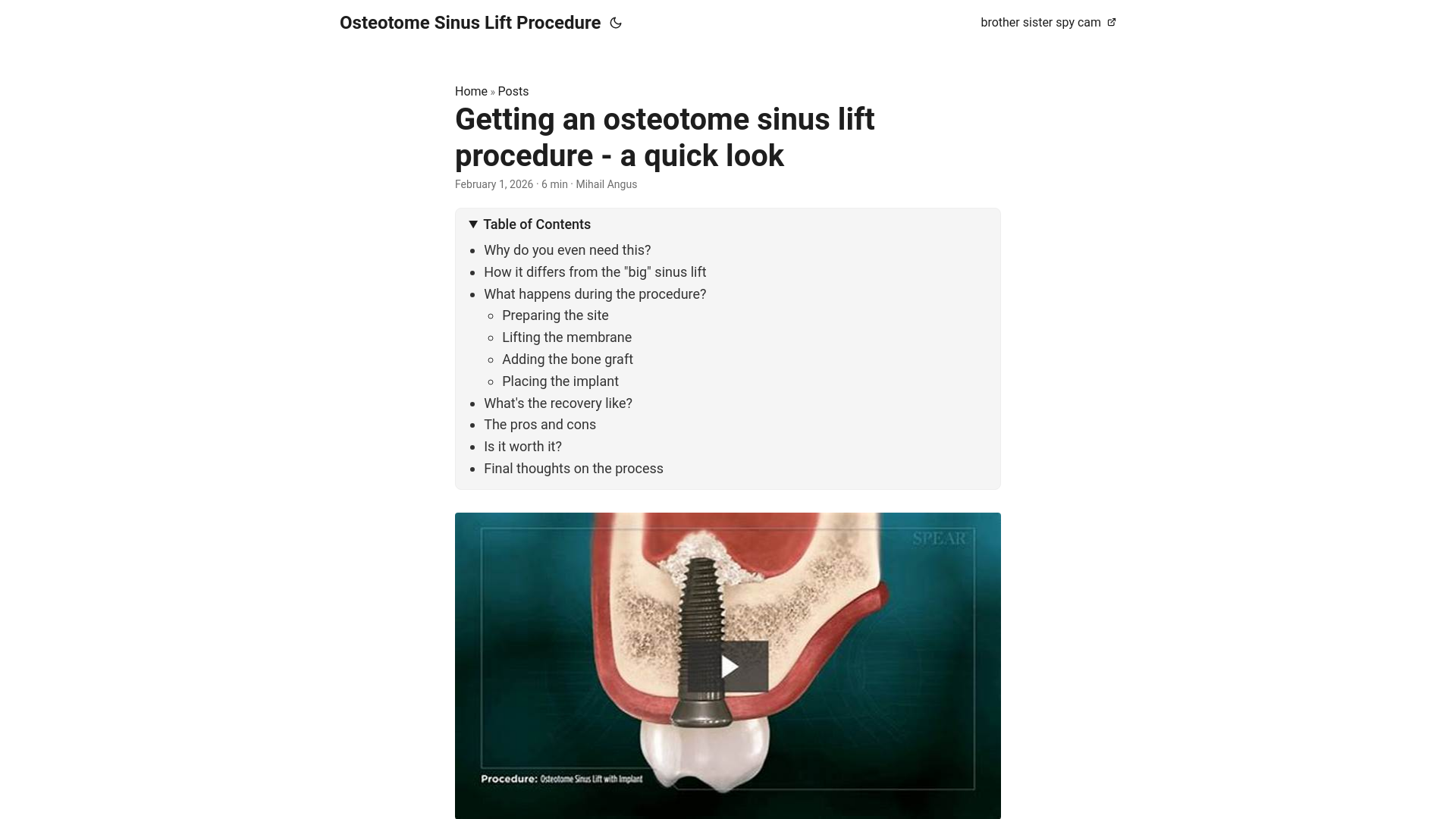 website screenshot of https://osteotome-sinus-lift-procedure.pages.dev/
