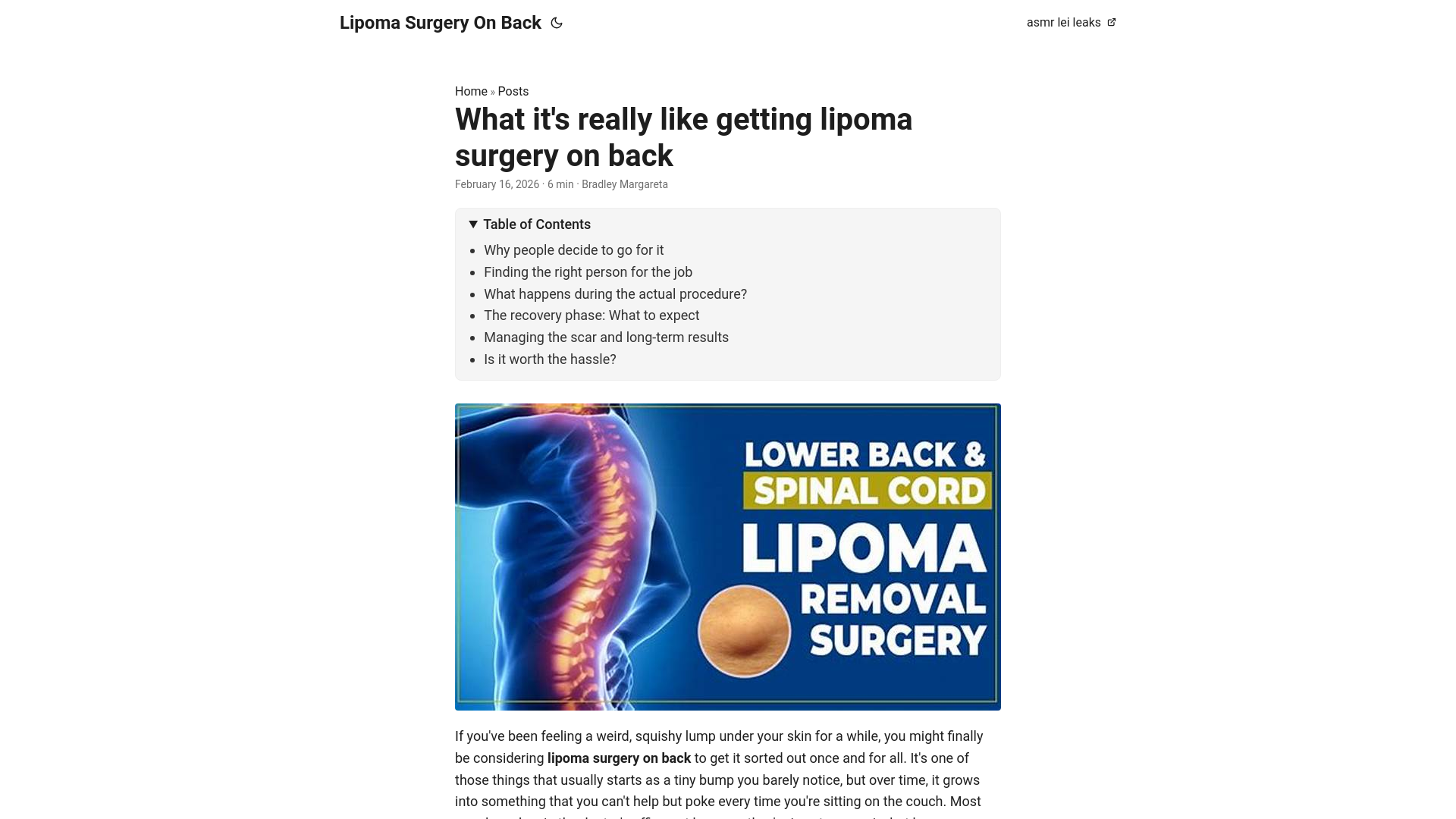website screenshot of https://lipoma-surgery-on-back.pages.dev/