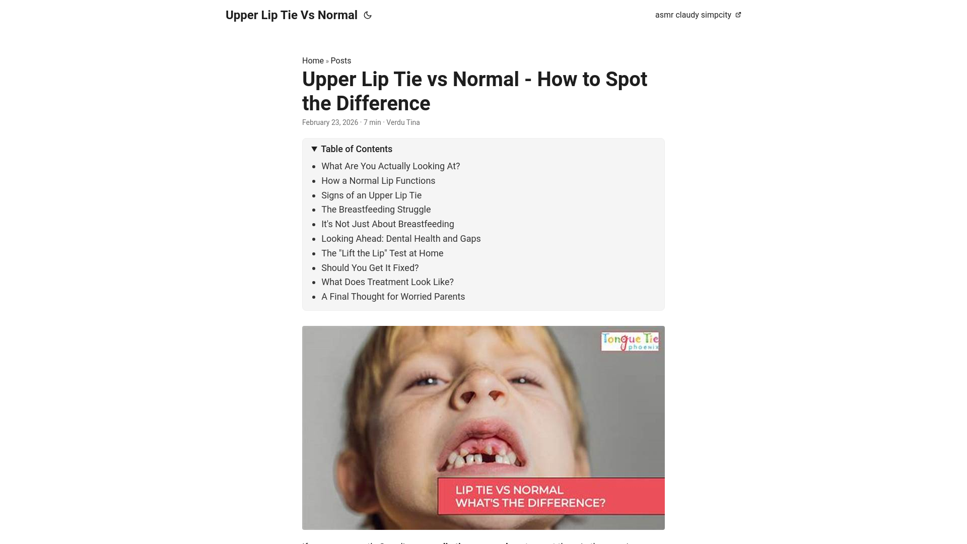 website screenshot of https://upper-lip-tie-vs-normal.pages.dev/