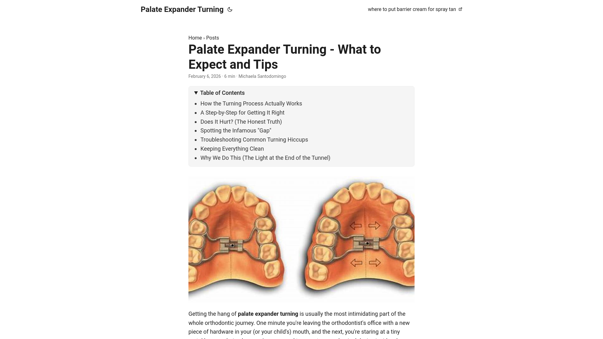 website screenshot of https://palate-expander-turning.pages.dev/