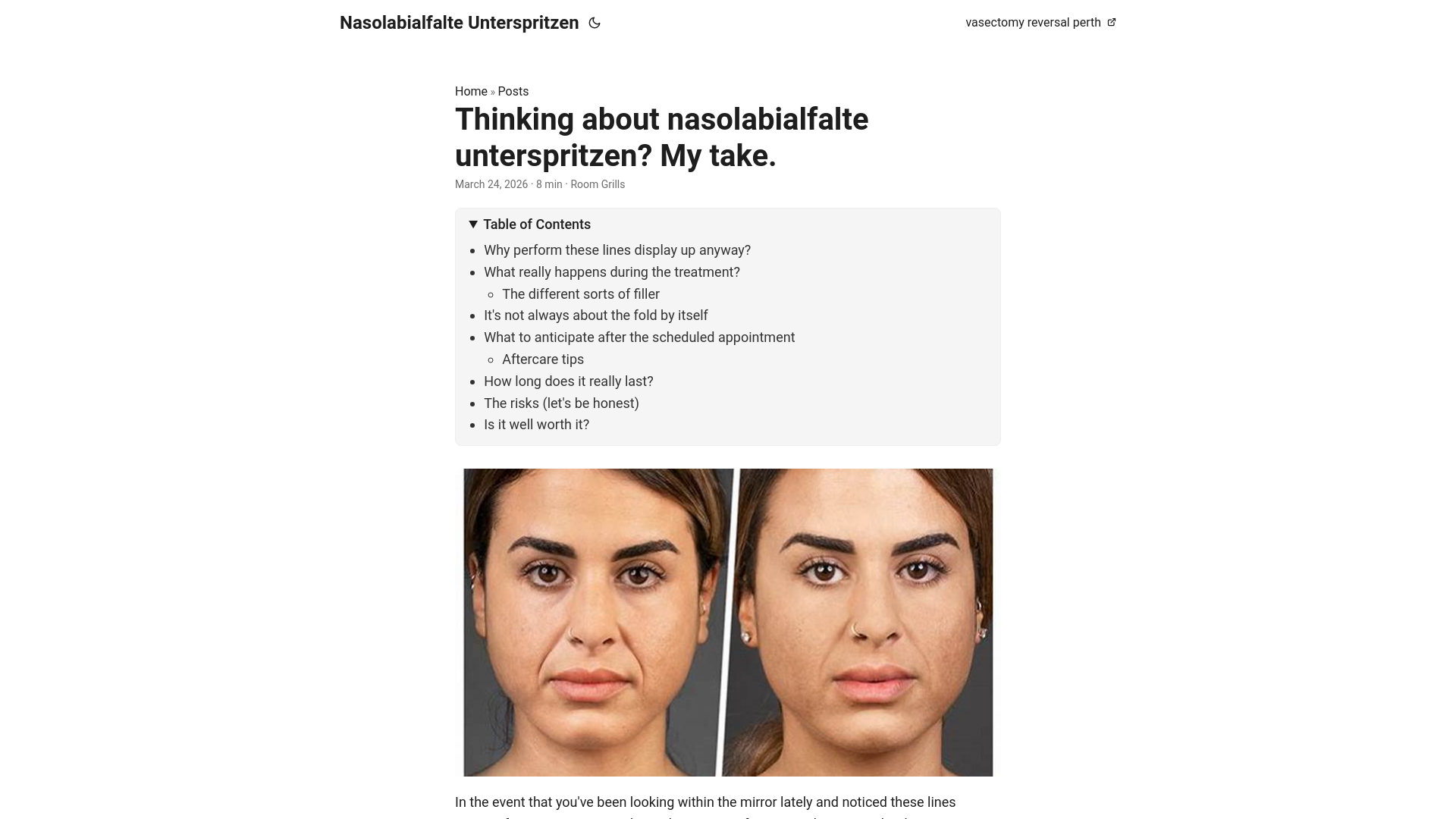 website screenshot of https://nasolabialfalte-unterspritzen.pages.dev/