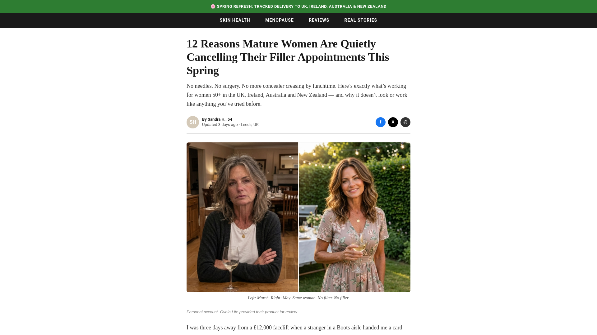 website screenshot of https://ovela-listicle-v1.pages.dev/