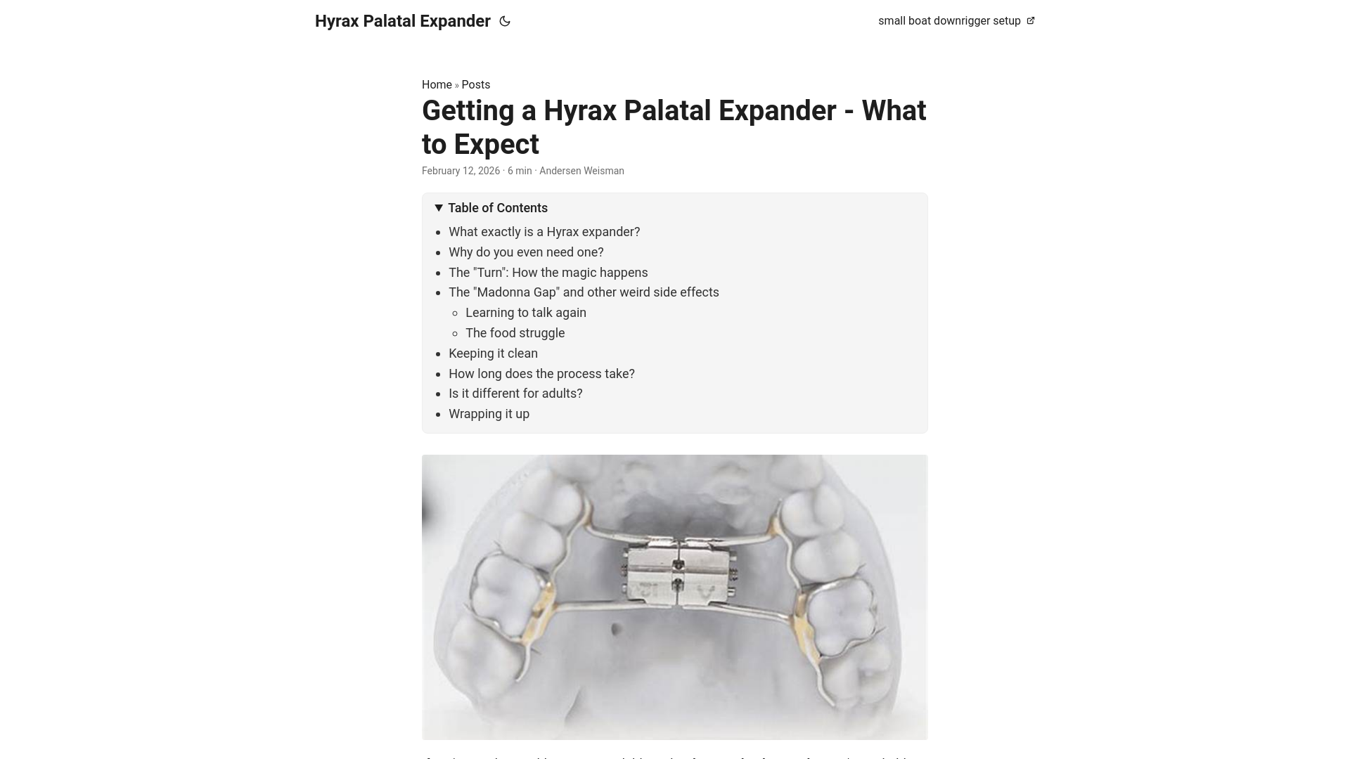 website screenshot of https://hyrax-palatal-expander.pages.dev/