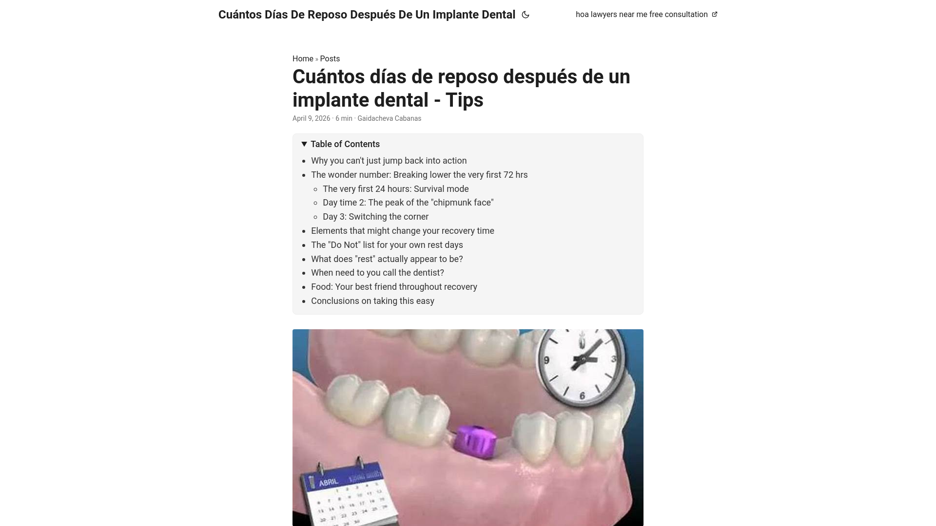 website screenshot of https://cuntos-das-de-reposo-despus-de-un-implante-dental.pages.dev/