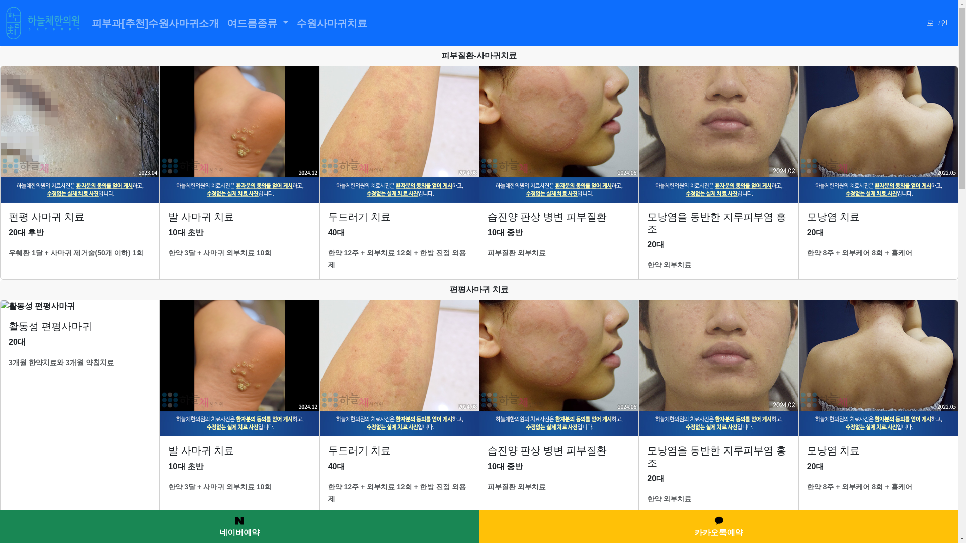website screenshot of https://suwonacne.com/