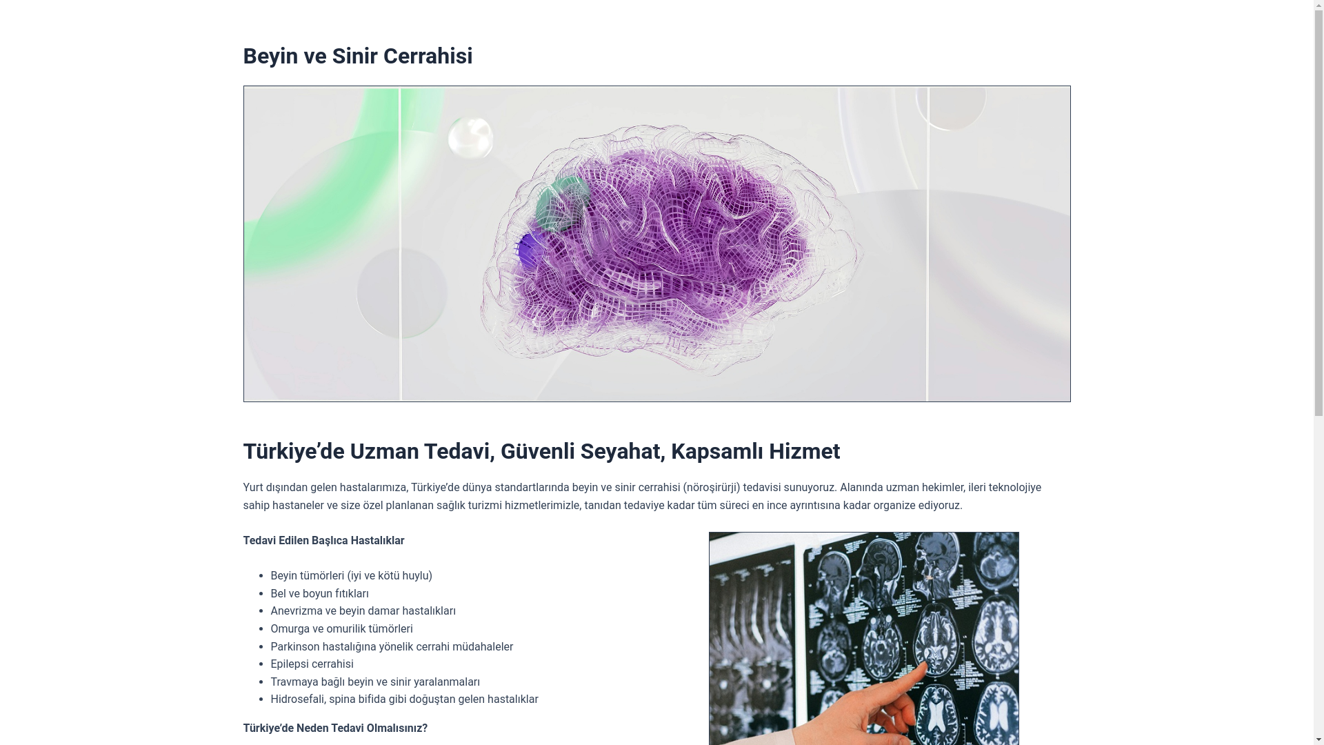 website screenshot of https://medipolpbrainsurgery-tr.pages.dev/