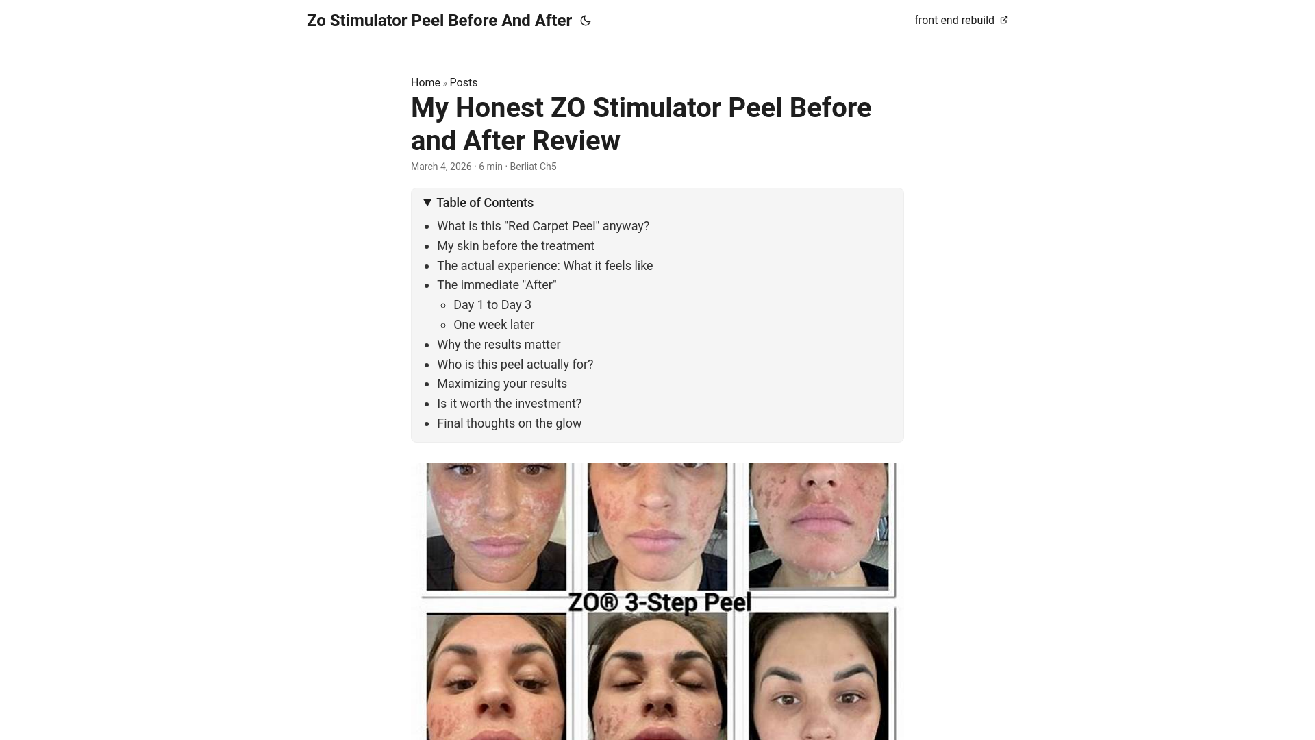website screenshot of https://zo-stimulator-peel-before-and-after.pages.dev/