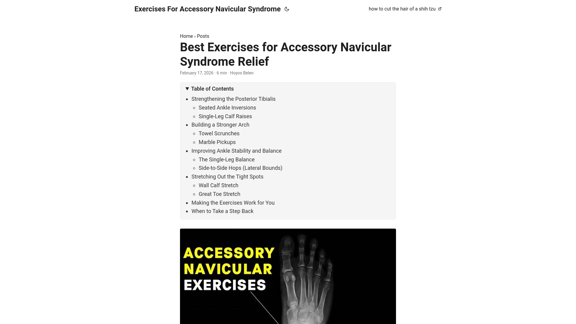website screenshot of https://exercises-for-accessory-navicular-syndrome.pages.dev/
