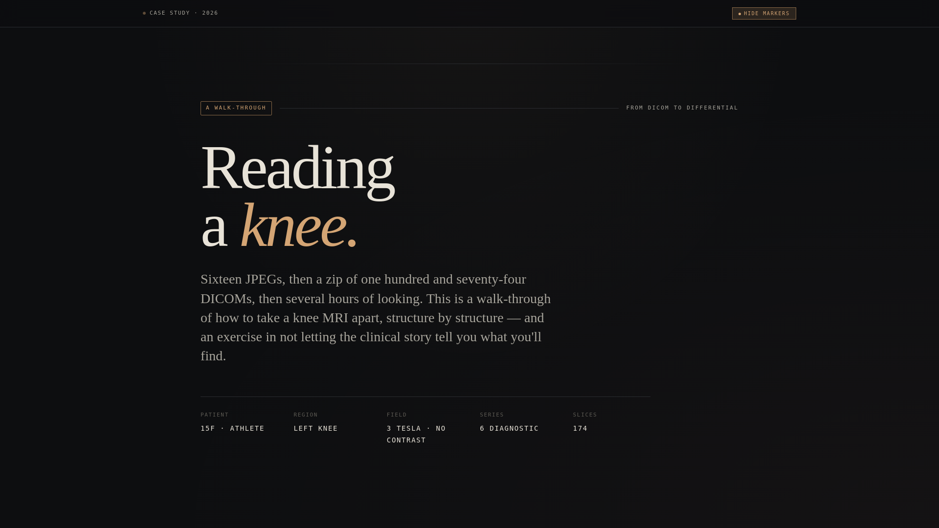 website screenshot of https://mri-diagnostic-report.pages.dev/