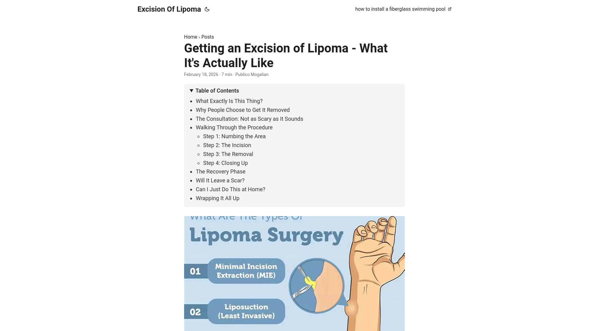 website screenshot of https://excision-of-lipoma.pages.dev/